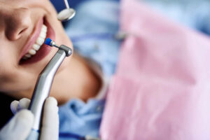 Qué duele más una endodoncia o sacar la muela