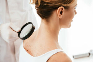 Cuál es la enfermedad más grave de la piel